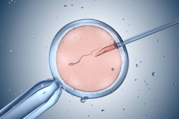 Infertility and IUI Guide
